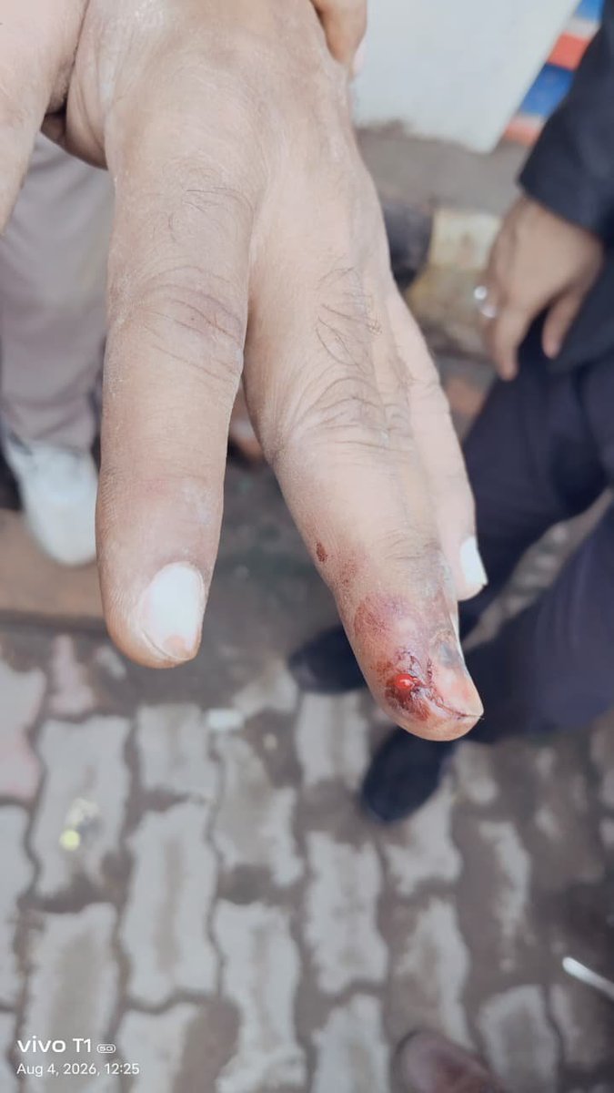 123e4t5's tweet photo. वाराणसी में भू-माफिया हमारी जमीन-दुकान पर कब्जे का प्रयास कर रहे हैं। महिलाओं से अभद्रता, बच्चों से मारपीट और जान से मारने की धमकी दी जा रही है। शिकायत के बावजूद स्थानीय पुलिस कार्रवाई नहीं कर रही। कृपया तत्काल कार्रवाई करें।@Uppolice @adgzonevaranasi @varanasipolice @DcpVns https://t.co/GilUJzuOuh