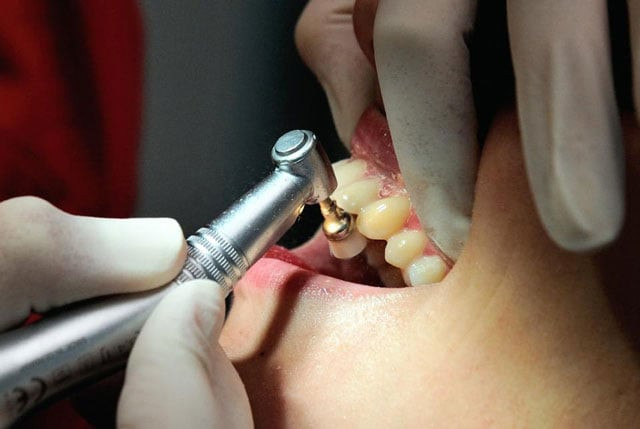 YunusKashmir's tweet photo. #Pakistan’s public dental #healthcare system is struggling under severe #shortages of specialists, outdated equipment and limited #treatment capacity, leaving millions with inadequate access to essential oral healthcare. @bdun53 @major_madhan @vipul2777 @RDXThinksThat https://t.co/II0BlnDPEW