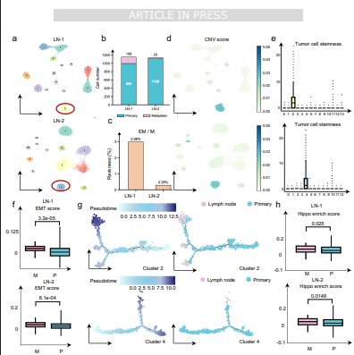 OhioStatePIIO's tweet photo. 🎉 Congratulations to #PIIO members on their new publication in @NatureComms! 👏
 
🧬 #Cancer is often most treatable before it spreads, yet identifying patients at risk remains a major challenge. This study introduces EmitGCL, an #AI-powered framework that combines multiple types of biological data to help identify patients at higher risk of metastasis and advance #precision_cancer_care.
 
👏 Congratulations to Xiaoying Wang, @Zihai Li, @DCarboneMD, @GangXin1, Lang Li, Kai He, @JordanKrull, and @QinMaBMBL  on this outstanding achievement!
 
📖 Read more: https://t.co/55wwSdTnTe
