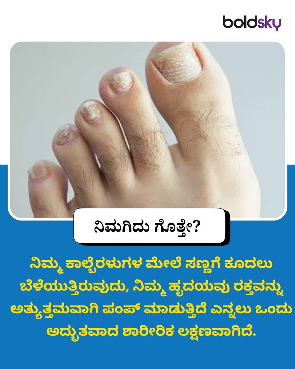 BoldskyKannada's tweet photo. ನಿಮ್ಮ ಕಾಲ್ಬೆರಳುಗಳ ಮೇಲೆ ಕೂದಲು ಬೆಳೆಯುತ್ತಿದೆಯಾ? ಹಾಗಾದ್ರೆ ಇದು ನಿಮ್ಮ ಹೃದಯದ ಆರೋಗ್ಯಕ್ಕೆ ಬೆಸ್ಟ್ ಸೈನ್!
.
.
#HealthFacts #HeartHealth #BloodCirculation #BodySigns #BoldSkyKannada https://t.co/hgZiPHrPoc