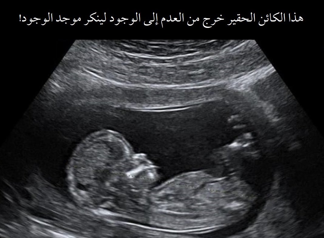 criticneutral's tweet photo. @1_Q_k سبحان الله 
"وفي أنفسكم أفلا تبصرون " https://t.co/oJccBmZcM5