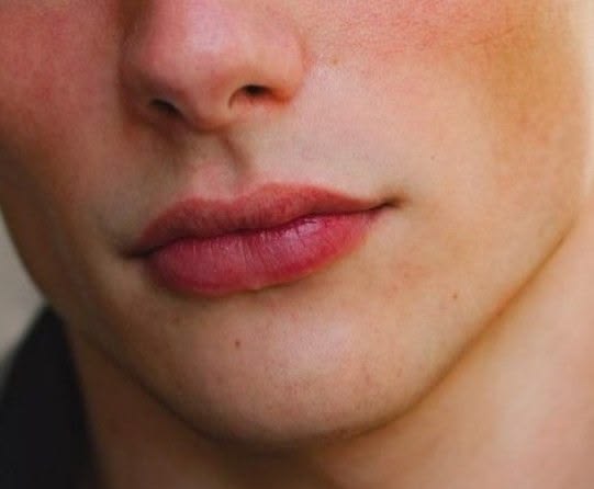 newusof's tweet photo. Si te sientes poco atractivo, necesitas hacer esto:

1. Arregla tus labios https://t.co/7vScWuOywV