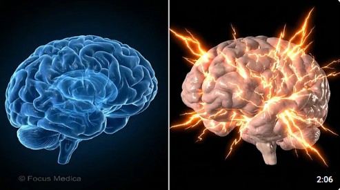 EPILESSIAINFO tweet picture