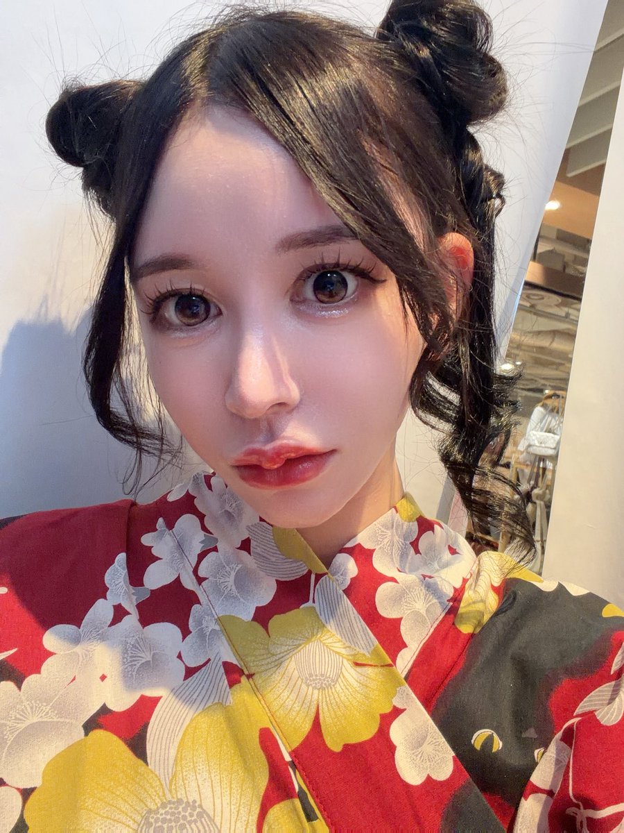 33333pyo's tweet photo. 韓国で再修正して3ヶ月経過しましたが、やって良かったです🥲🥲🥲🥲🥲
先生ありがとうございました🥰🥰

 #目整形  #全切開  #再修正  #ダウンタイム https://t.co/19hfBOucyK
