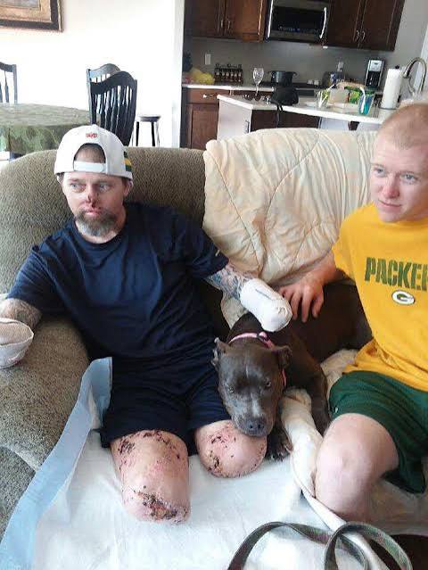 Andi754632's tweet photo. @B1TuckerCarlson This man lost all his limbs after a dog lick. Please dont let dog eat from your plate, it is very unhygienic. https://t.co/AGI4hhRcbq