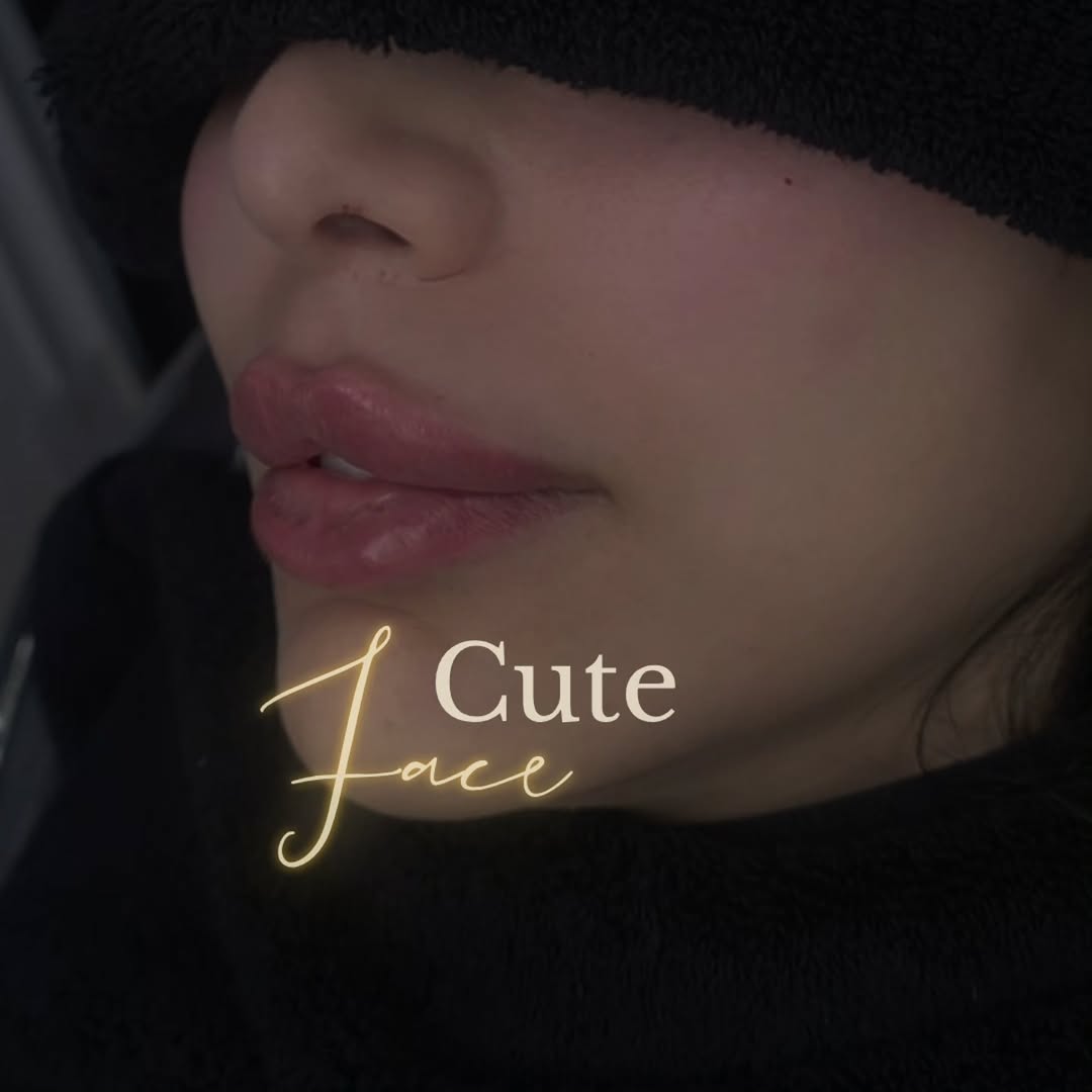dr_laracheajfuc's tweet photo. Cute face? Natural look?
Book your appointment. https://t.co/g6utzL92we