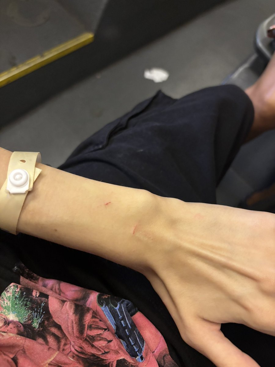 fyodorihg's tweet photo. I got fucking demolished by a stray cat https://t.co/RL5zbnGoLx