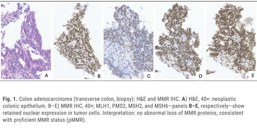 AMPath's tweet photo. Don’t forget to check out the latest AMP report in CAP Today, which looks at hypermutated stage IIC colon cancer with a rare POLE exonuclease variant and co-occurring MSH6 and PIK3CA alterations.

Read the full case report: https://t.co/amlTKoTihY https://t.co/yW2ZkpCh9u