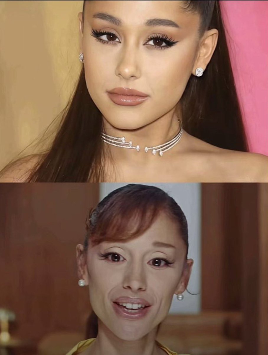 Crosski99227132's tweet photo. “She looks the same” “‘she’s the healthiest she’s ever been” “she looks stunning” “omg she’s so beautiful” “I’m gagging”. Y’all just be lying to this woman for what reason? This is 2019 vs 2026 face card, if u think she looks d same n she’s healthy u are mentally ill! https://t.co/0OAEh8Fo0j