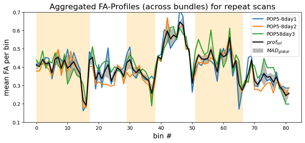 Preoperative's tweet photo. What approaches are you using to assess scanner stability and reproducibility across sites and over time?

 (8/8) https://t.co/Pyiqd2POaB