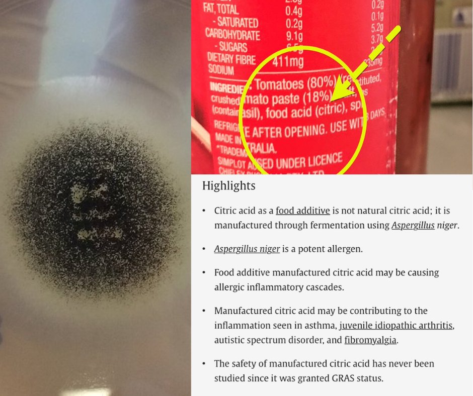 lowmegatron's tweet photo. Manufactured citric acid is a common allergenic and inflammatory food additive. It’s made from a mold called aspergillus niger, which produces numerous toxins. 

It is implicated in IBD, IBS, asthma, arthritis, autistim spectrum disorder, and fibromyalgia. The safety of mold derived citric acid has never been tested.

“We present four case reports of patients with a history of significant and repetitive inflammatory reactions including respiratory symptoms, joint pain, irritable bowel symptoms, muscular pain and enervation following ingestion of foods, beverages or vitamins containing manufactured citric acid. We believe that ingestion of the manufactured citric acid may lead to a harmful inflammatory cascade which manifests differently in different individuals based on their genetic predisposition and susceptibility, and that the use of manufactured citric acid as an additive in consumable products warrants further studies to document its safety.” 

The issue here is not citric acid itself, but the potential for mold toxins to make it into manufactured citric acid.

"A. niger has the potential to produce two groups of potentially carcinogenic mycotoxins: fumonisins and ochratoxins. In this study all available industrial and many non-industrial strains of A. niger (180 strains) as well as 228 strains from 17 related black Aspergillus species were examined for mycotoxin production. None of the related 17 species of black Aspergilli produced fumonisins. Fumonisins (B(2), B(4), and B(6)) were detected in 81% of A. niger, and ochratoxin A in 17%, while 10% of the strains produced both mycotoxins. Among the industrial strains the same ratios were 83%, 33% and 26% respectively. Some of the most frequently used strains in industry NRRL 337, 3112 and 3122 produced both toxins and several strains used for citric acid production were among the best producers of fumonisins in pure agar culture."

Ref: 
Potential role of the common food additive manufactured citric acid in eliciting significant inflammatory reactions contributing to serious disease states: A series of four case reports
Fumonisin and ochratoxin production in industrial Aspergillus niger strains

https://t.co/hyWw7g7Iqp
