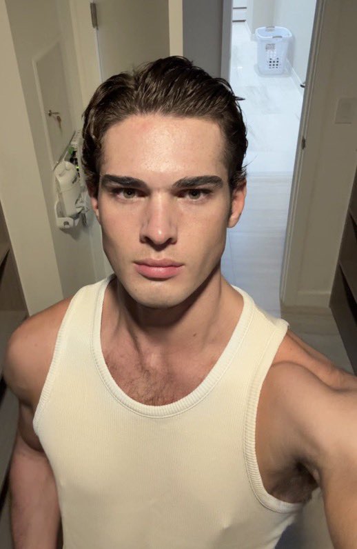 Pulcys's tweet photo. Clavicular shows off his transformation just 2 months after undergoing multiple surgeries At 20 years old👀

Before vs After https://t.co/N8bo8jU4WC
