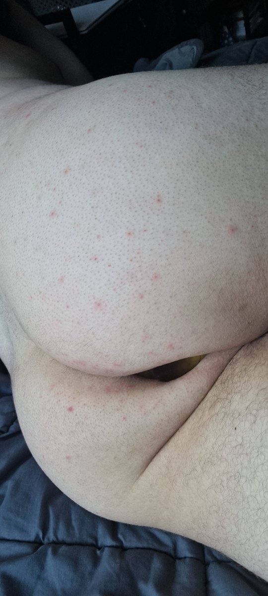 Teihiro_1's tweet photo. [Day 45/400🔒]

I kept my plug in for 24 hours straight (except for bathroom breaks, obviously) and wow, I felt like a horny slut all day, from the moment I woke up and throughout my entire workday 😵‍💫😵‍💫😝

#slave #bdsm #submissive #dom #chastity #teamlocked #chastitycage #bitch https://t.co/LAyzLoV1il