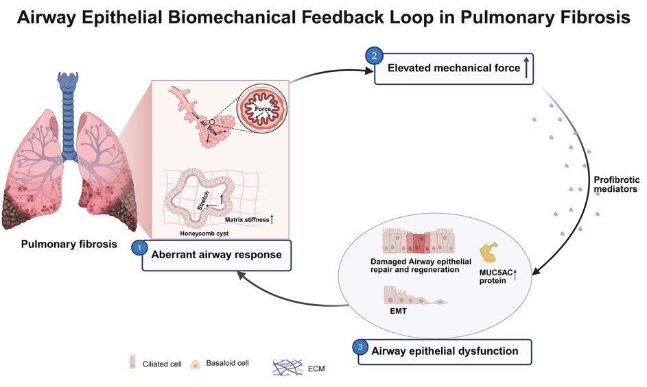 AJRCMB's tweet photo. The interplay of airway epithelium and biomechanical stress in pulmonary fibrosis

https://t.co/dTc0vw7bGV
@atscommunity https://t.co/kiJdWrfN6X
