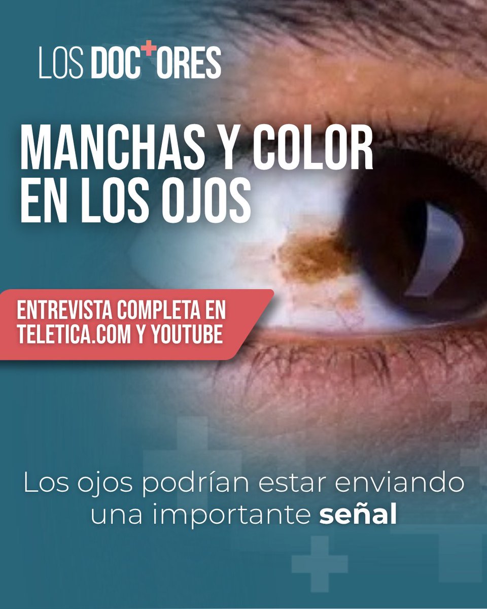 Teleticacom's tweet photo. Activá la 🔔 y repasá #LosDoctores aquí: https://t.co/lLAksG029i. 👈 | Los ojos pueden reflejar mucho más que nuestra visión. Cambios en su color o la aparición de manchas pueden ser una señal de distintas condiciones que requieren valoración médica. https://t.co/IvLl33eC8R