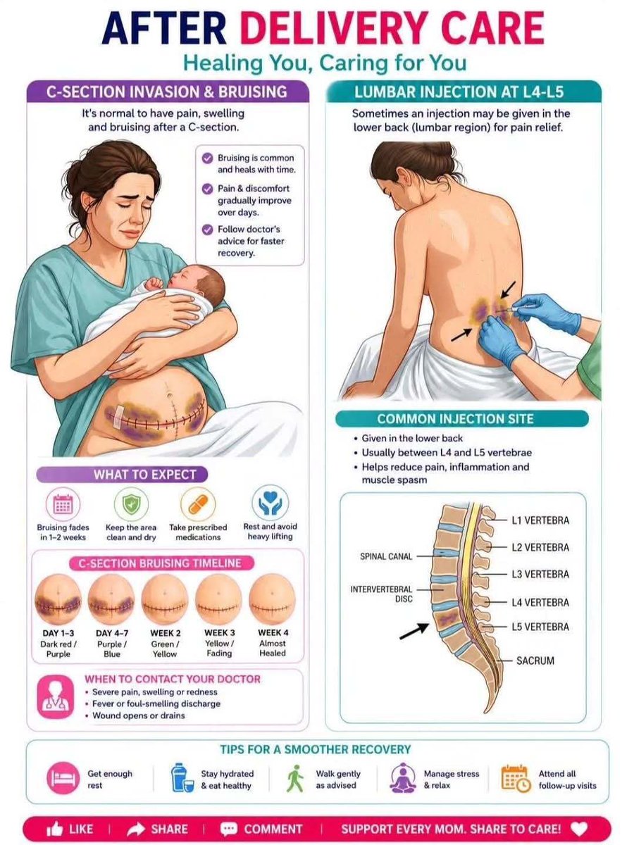 tachwisdom76's tweet photo. After Delivery Care . https://t.co/PjZhTD5qfh