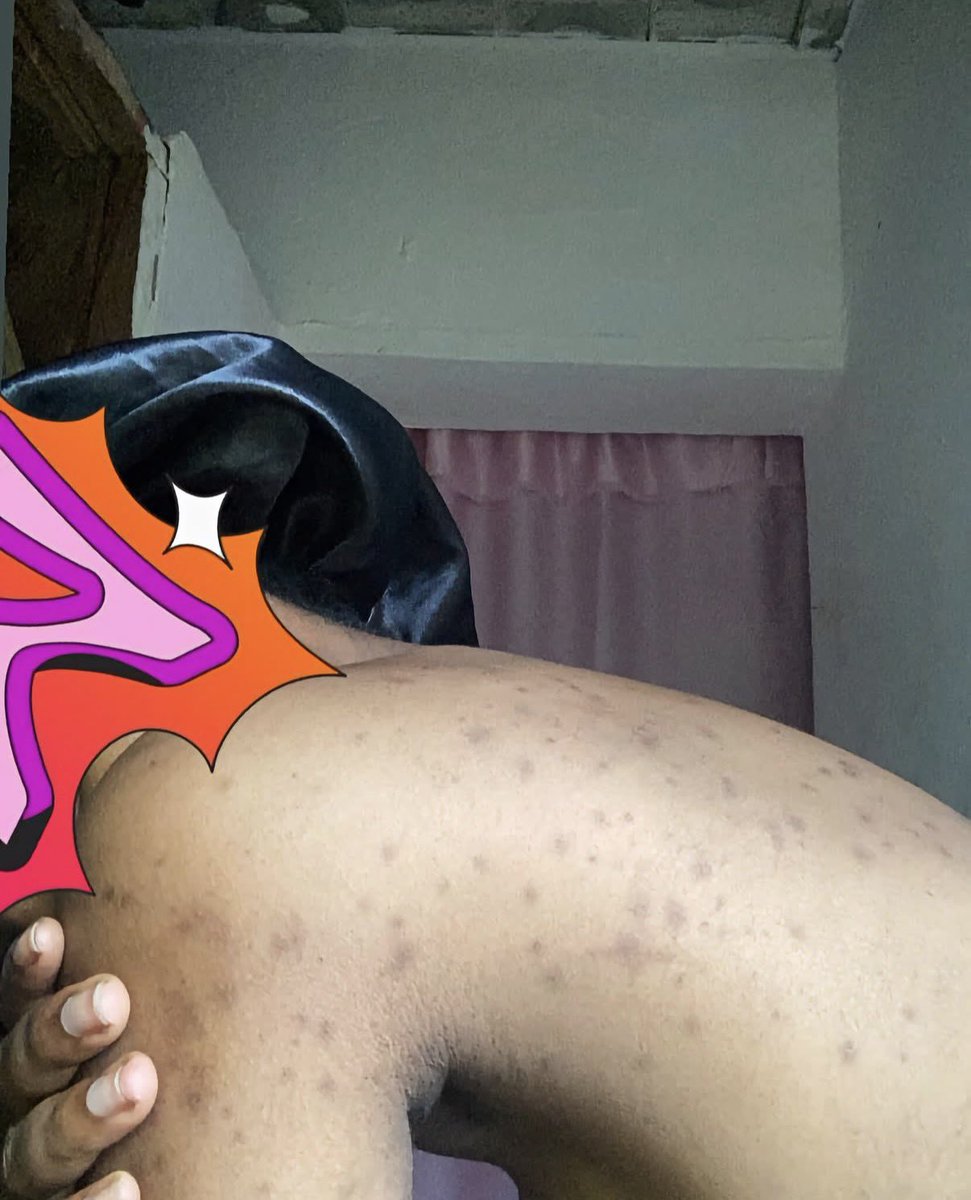 mosleee_s's tweet photo. Hey @grok, what do you think is causing this, and what’s the best treatment for it? https://t.co/i2QKjEnmGQ