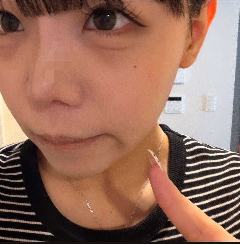 ji20103j's tweet photo. 最近ずっと無加工でしか写真撮ってないけど
色んなメイクするのが楽しすぎる😭🎶🎶
無加工で撮ると鼻の毛穴見えるのだけがマジ勘弁😭😭鼻の毛穴どうやったら治りますかな❓😨😨😨😨がびちょーん😨 https://t.co/CUlAuj9XE7