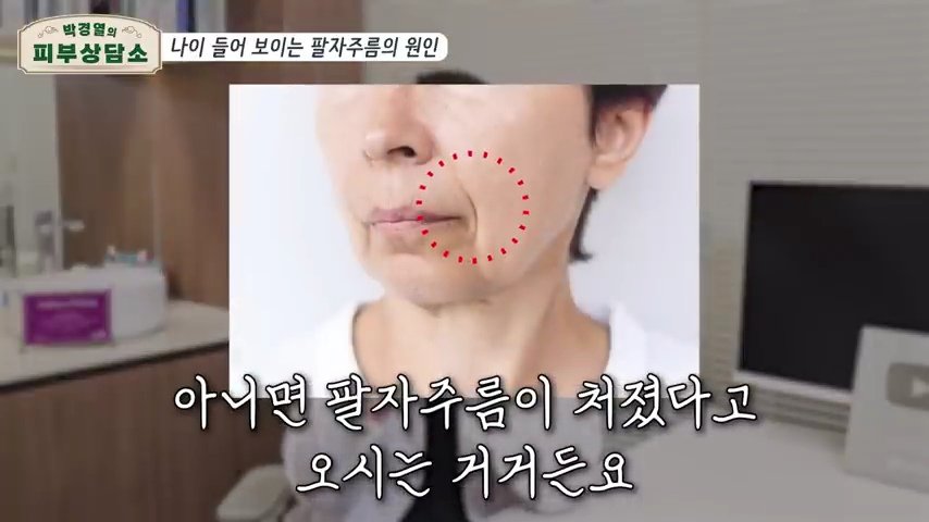 Alexlim1004's tweet photo. 팔자주름  병원 안가고
집에서 쉽게 없애는 방법!!

1.팔자 주름이 생기는 4가지 대표 유형 

-볼 처짐: 피부가 얇아지면서 볼살이 흘러내려 접히는 경우 

-볼륨 감소: 나이가 들면서 뺨이나 팔자 부위의 살이 빠져 꺼지는 경우 

-표정 주름 (칼주름): 반복된 표정이나 씹는 동작으로 피부에 깊은 실금이 가는 경우 

-구조적 원인: 10~20대부터 입이 살짝 나오거나 중안면부가 들어간 경우 

2.안쪽에서 펴주기 (입 안 마사지) 

-손을 깨끗이 씻거나 장갑을 낀 뒤, 엄지손가락을 입 안에 넣고 팔자 주름 부위를 안쪽에서 바깥쪽으로 부드럽게 밀어내듯 펴줘. 

-이때 꼬집지 말고, 안쪽에서 딱딱하게 걸리거나 뭉친 부위를 살살 풀어주는 게 포인트! 

3.바람 넣기 운동 (볼륨 & 근육 강화) 

-​윗 잇몸과 인중 쪽에 공기를 가득 넣어 팔자 부위를 빵빵하게 만들어줘. 

-공기가 새지 않게 입술을 꽉 다물고 10초간 버텼다가 숨을 내쉬는 동작을 총 6회 반복! (한쪽만 하면 반대쪽이 접히니까 꼭 양쪽 동시에!) 

4.바깥에서 결 따라 눌러주기 

-검지와 중지를 모아 팔자 주름 결을 따라 꾹 눌러주며 바깥 방향으로 부드럽게 펴줘. 

-​피부에 자극이 가지 않도록 너무 세게 누르지 말고 적당한 압으로 약 1분간 진행해. 

5.광대 & 림프 순환 마사지 

-콧망울 옆 홈에 검지 마디를 대고, 광대뼈 아래 라인을 따라 관자놀이와 귀 앞쪽 방향으로 쓸어 올려줘. 

-​귀 앞과 귀 밑 림프절에 도달하면 3초간 지긋이 눌러주기! (※ 왕복하지 말고 반드시 안쪽에서 바깥쪽으로 한 방향으로만 진행) 

너도 요즘 얼굴 주름이나 처짐 때문에 고민해 본 적 있어? 혹시 따로 하고 있는 얼굴 케어 루틴이 있다면 알려줘?