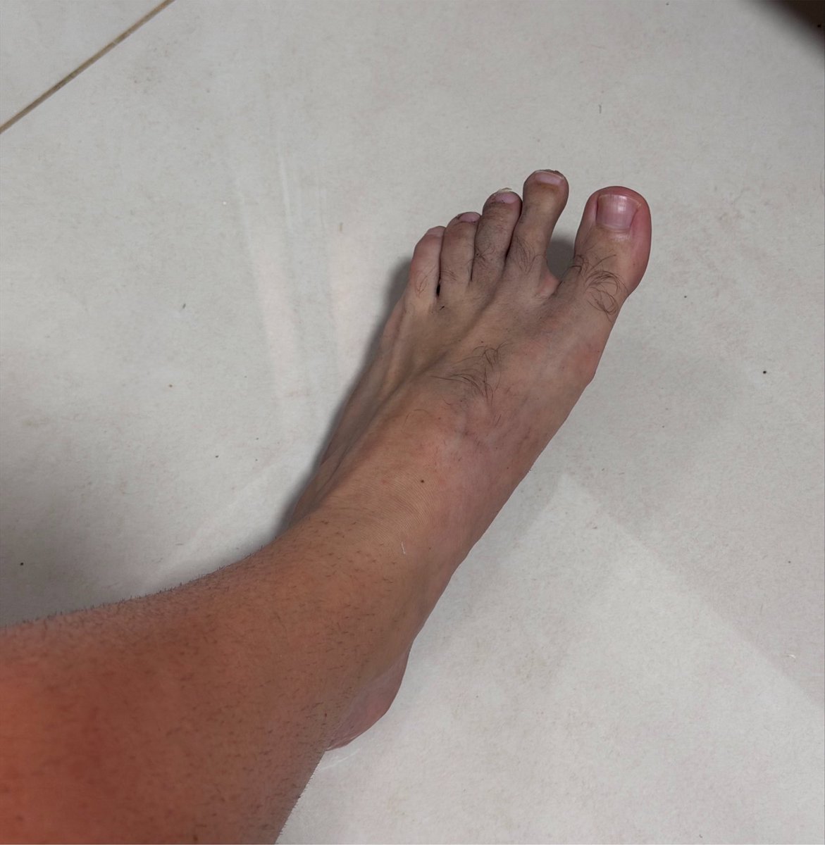 peisbarros's tweet photo. Isso que dá sair de casa e esquecer o chinelo. 🩴 
Pézin do Pedrin Sujin. https://t.co/sxO03RAEHS