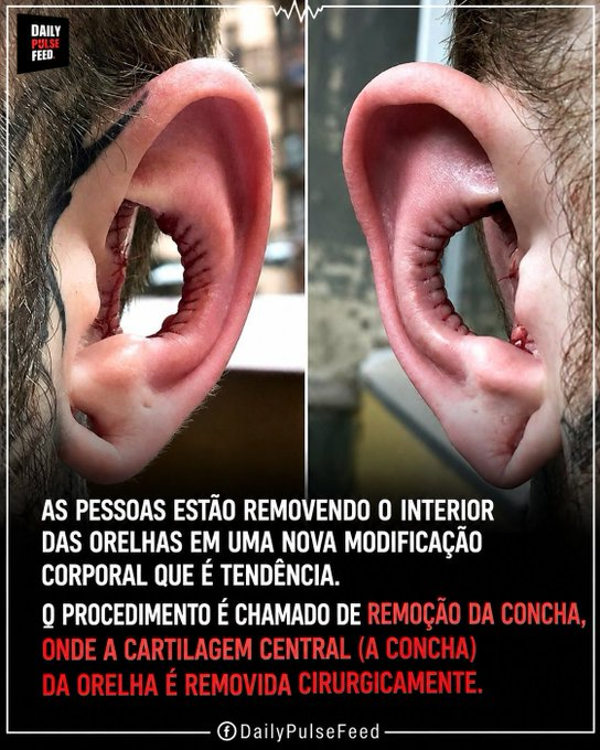 0C0RV0's tweet photo. O se humano tá ficando cada vez mais doente https://t.co/1nQb6ePUDc