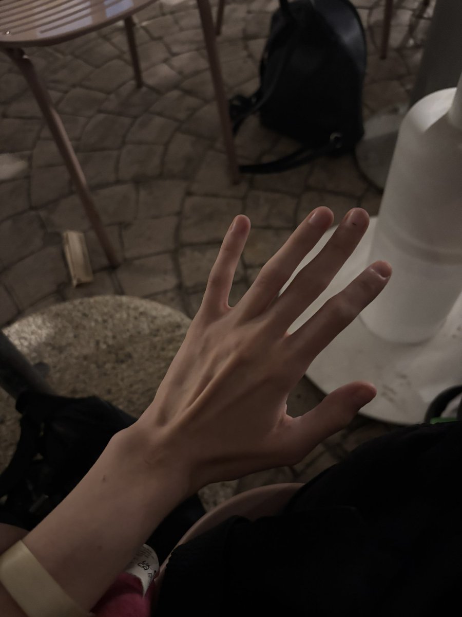 fyodorihg's tweet photo. What bmi do my hands look like? #edtwt https://t.co/ZyXOLVqAQx