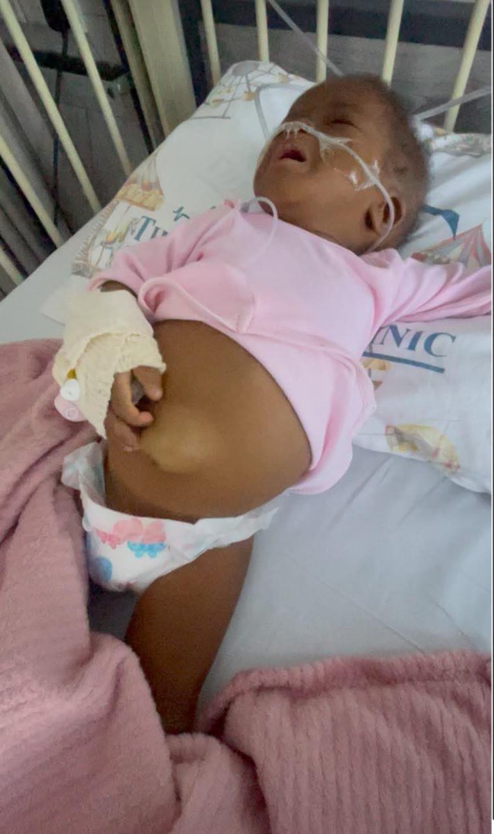 CrimeWatchZW's tweet photo. PLEASE SHARE🙏🏾 | One-year-old Naomi Chigwada is ill and urgently needs a liver transplant, and her family is appealing for help to raise US$18,000 for her life-saving treatment.

Naomi cannot receive the transplant in Zimbabwe because the procedure is not available locally. Her only chance is to travel to India, where one of her parents can be the living donor, allowing the transplant to be done without a long waiting list.

The money raised will cover the cost of the transplant, as well as travel and accommodation for Naomi and her parents during treatment.

Naomi’s family is asking for your support. If you are unable to donate, please consider sharing this post. A single share could help the fundraiser reach someone who is able to assist.

Every donation, share, and message of support brings Naomi one step closer to the treatment she urgently needs.

You can contribute via Ecocash or Innbucks using 0772528286 (Confidence Kundhlande). A GoFundMe link is also available below.