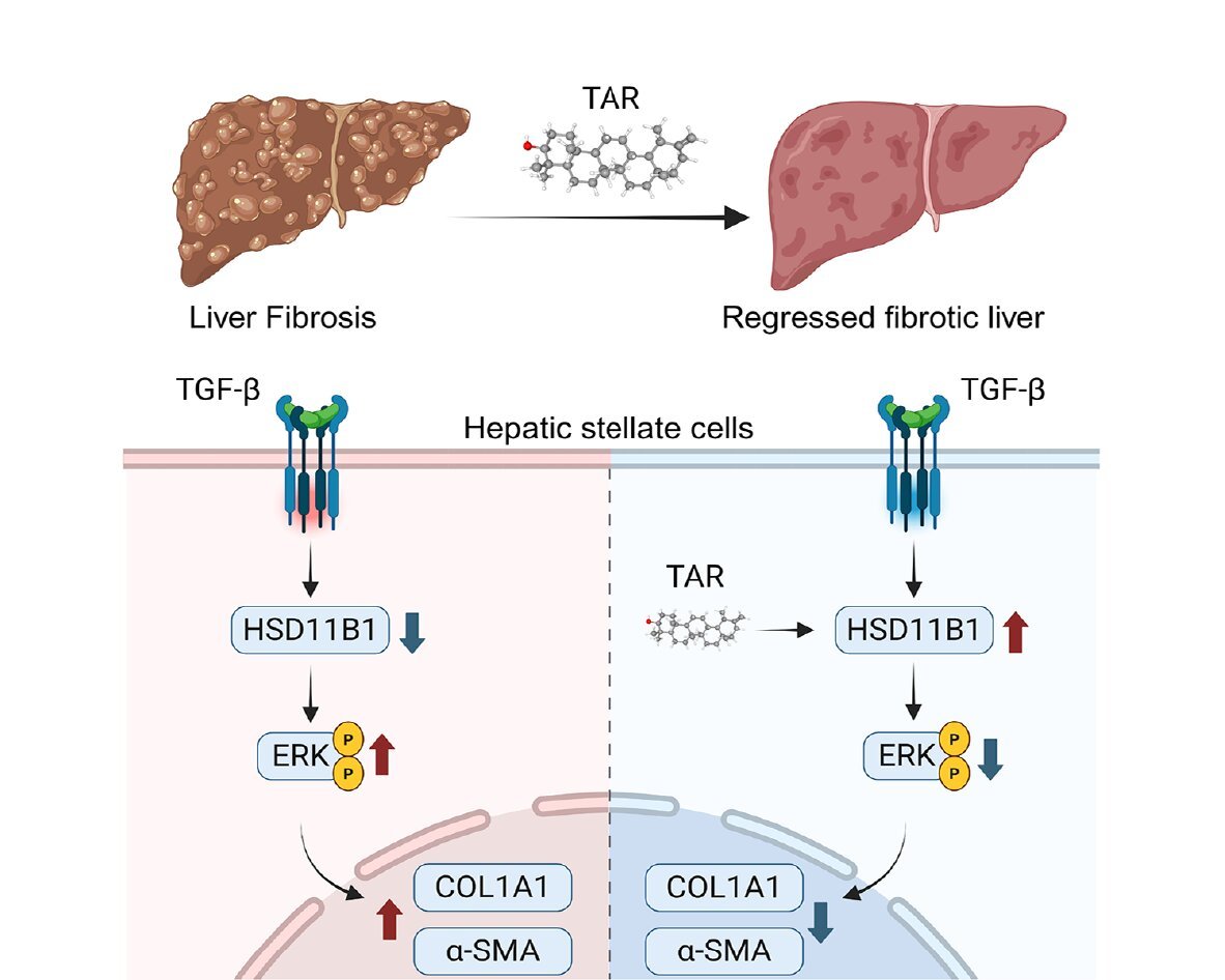 ABBSjournal's tweet photo. Taraxasterol alleviates liver fibrosis by suppressing hepatic stellate cell activation via the HSD11B1-ERK MAPK signaling axis
https://t.co/J5SXDCSS3u
#liver_fibrosis #HSD11B1 #taraxasterol #hepatic_stellate_cell
#MAPK_signaling_pathway https://t.co/4JBxyf8mTP