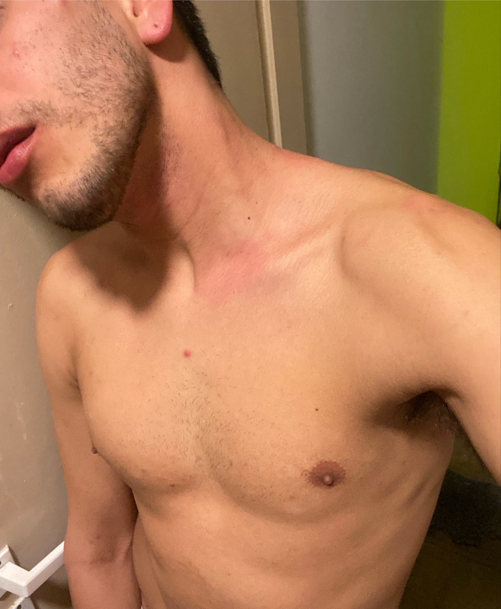 onefirewachin's tweet photo. Cuando te ahorcan tan fuerte que te dejan marcado 😍🙏🏼 https://t.co/GuwdBoodSl