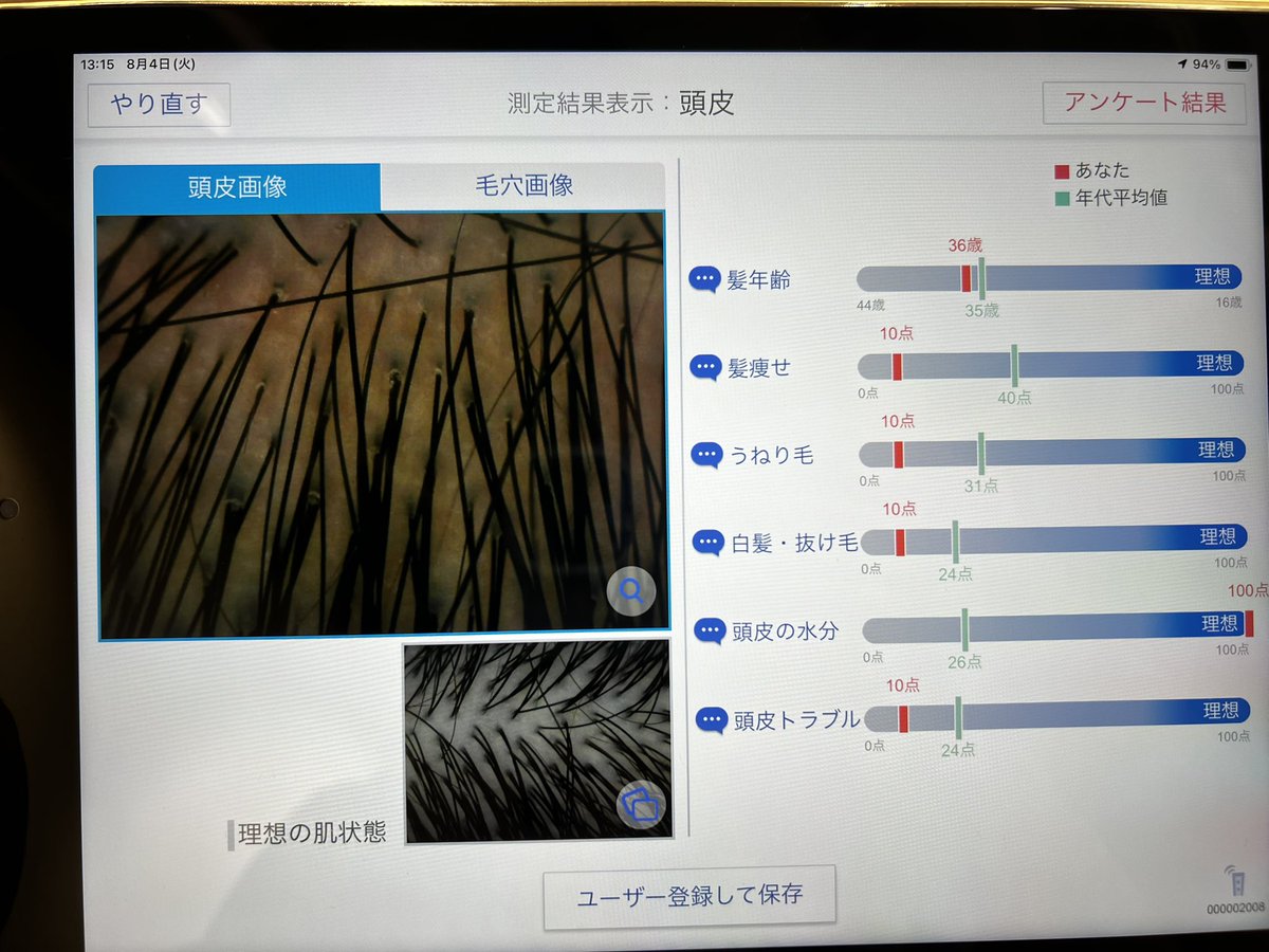 midorinojam's tweet photo. そしてドライヤーが壊れた話を森田さんにした時に教えてもらったヨドブルーム @yodobloom に予約して行ってきました！
実際にその場でシャンプーをしてもらってから、自分に合いそうなドライヤーをいくつか選んで比較してもらえるサービスにしたんだけど、頭皮診断もしてもらえた👀 https://t.co/wYe1H6OAhu