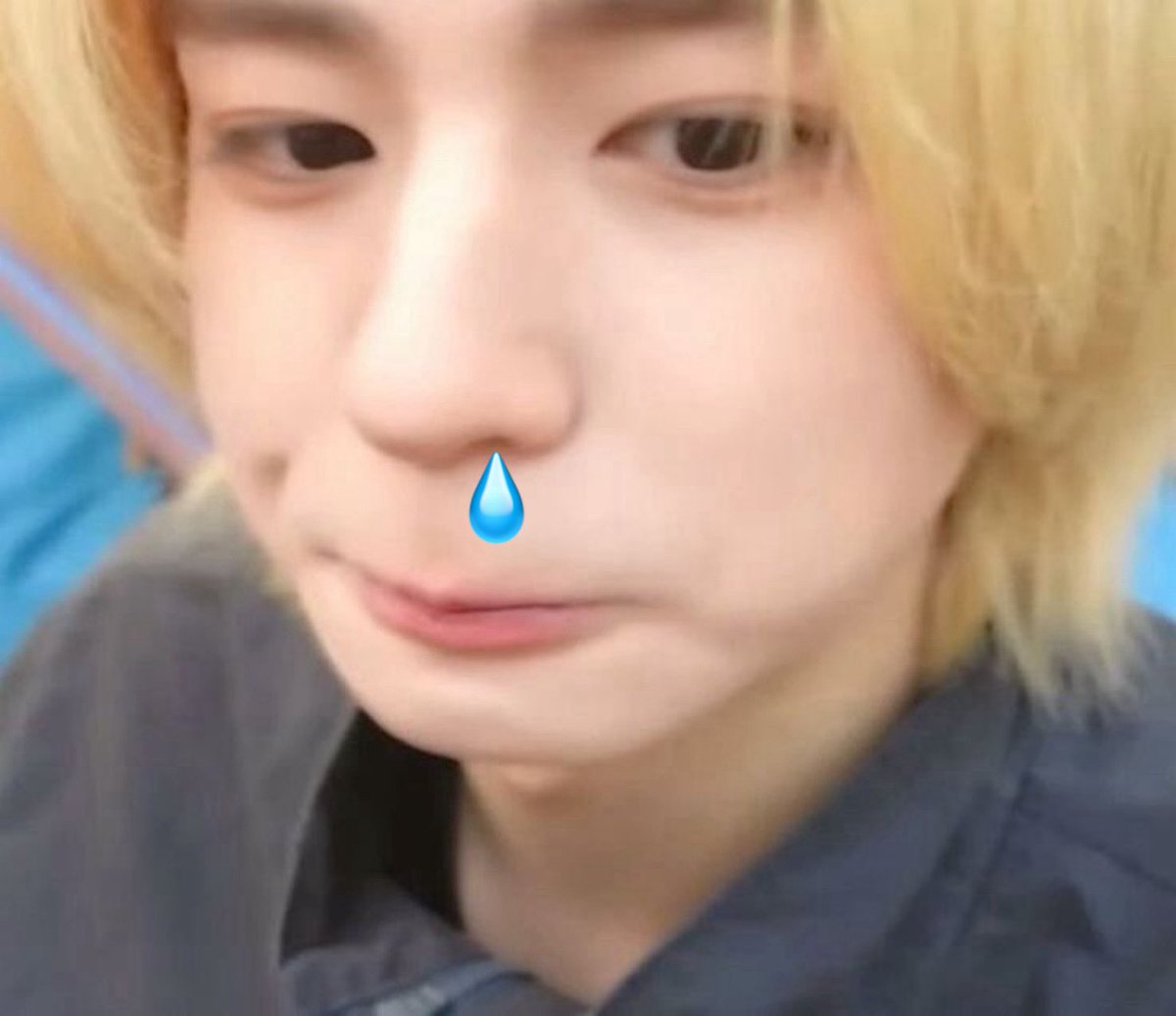 itsselenophiles's tweet photo. น้องอันบอกมาถอนฟันคุด ตอนนี้ขึ้นเขียงแล้ว https://t.co/iY0iqwCuSo