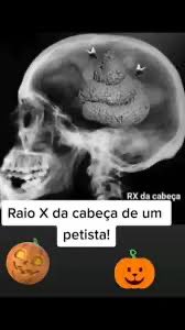 BiraExperince's tweet photo. @Gustavramski_ @FlavioBolsonaro Pois é,os ESQUERDOPATAS precisam ser mandados para Marte e serem estudados….
O L de LADRÃO e suas quadrilhas(luLALAU e seus 40 LADRÕES)assaltam os cofres públicos,porém o JUMENTIS vem falar de uma foto tirada!😂🤣😂🤣

Pois bem, ao invés de 🧠 os ESQUERDOPATAS têm 💩na cabeça! https://t.co/N4JCFsW1gO