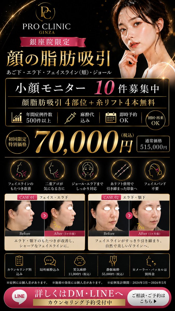 PRO_CLINIC_'s tweet photo. 😱銀座で顔の脂肪吸引が70,000円⁉️

通常515,000円が
モニター限定・期間限定でこの価格

✅ あご下・エラ下・フェイスライン・ジョール【4部位】
✅ 糸リフト4本 無料追加
✅ 形成外科医在籍・年間500症例以上
✅ 初診・カウンセリング・麻酔代 すべて込み
✅ フェイスバンド不要

「顔が丸い」「二重アゴが気になる」
1回の施術でスッキリ解決します🔥

残り10名 → DMまたは以下より予約へ：
https://t.co/WaftGWfLrv

#顔の脂肪吸引 #小顔 #銀座美容外科
#糸リフト #二重アゴ解消 #フェイスライン
#PROCLINIC銀座 #形成外科医