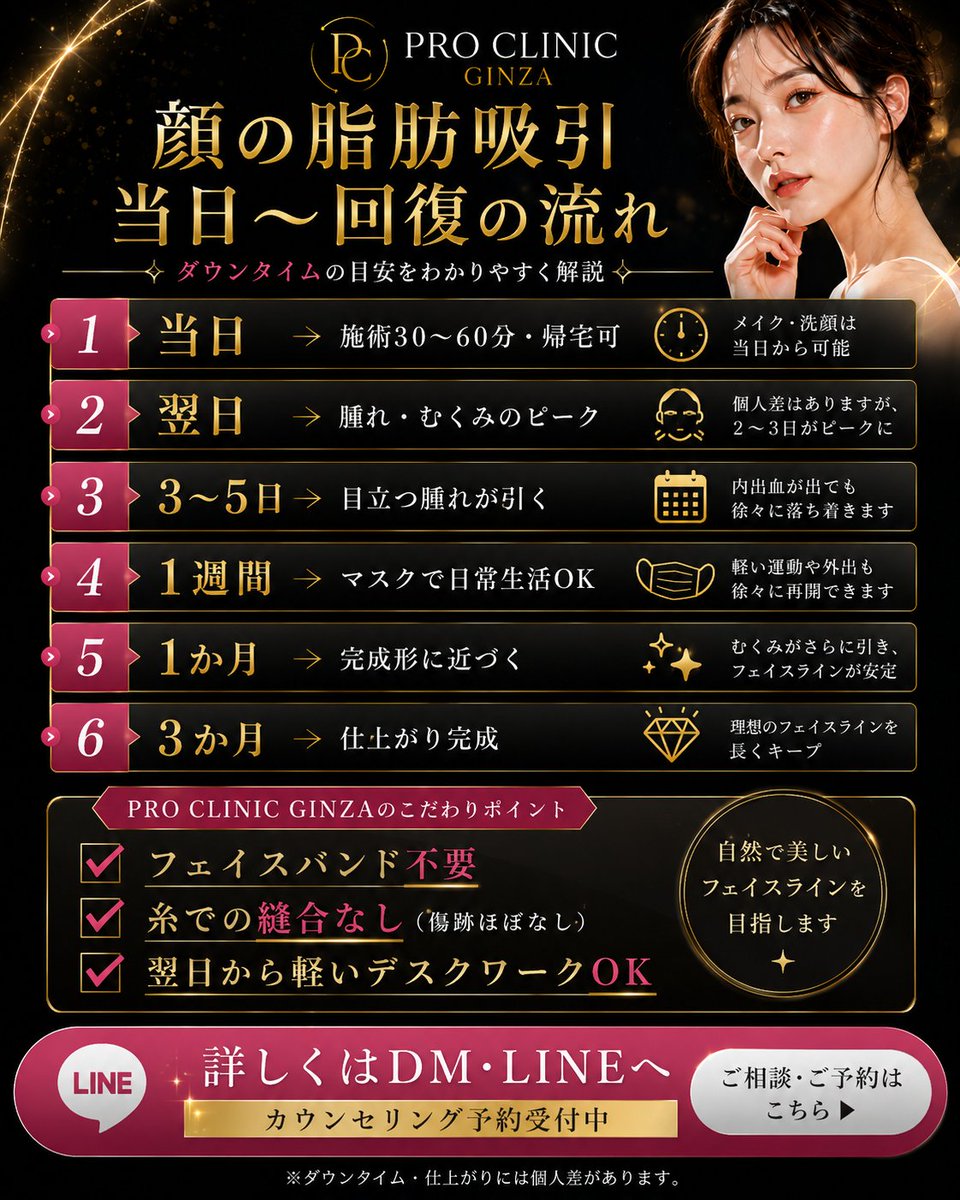 PRO_CLINIC_'s tweet photo. 【当日〜回復の流れ】

当日    → 施術30〜60分・帰宅可
翌日    → 腫れ・むくみのピーク
3〜5日  → 目立つ腫れが引く
1週間   → マスクで日常生活OK
1か月   → 完成形に近づく
3か月   → 仕上がり完成

✅ フェイスバンド不要
✅ 糸での縫合なし（傷跡ほぼなし）
✅ 翌日から軽いデスクワークOK https://t.co/RnmfYntFdQ