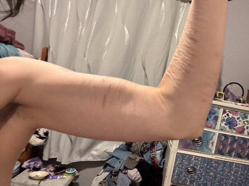 lightssacrifice's tweet photo. before and after :( got so fat https://t.co/kRmLMD2AbI