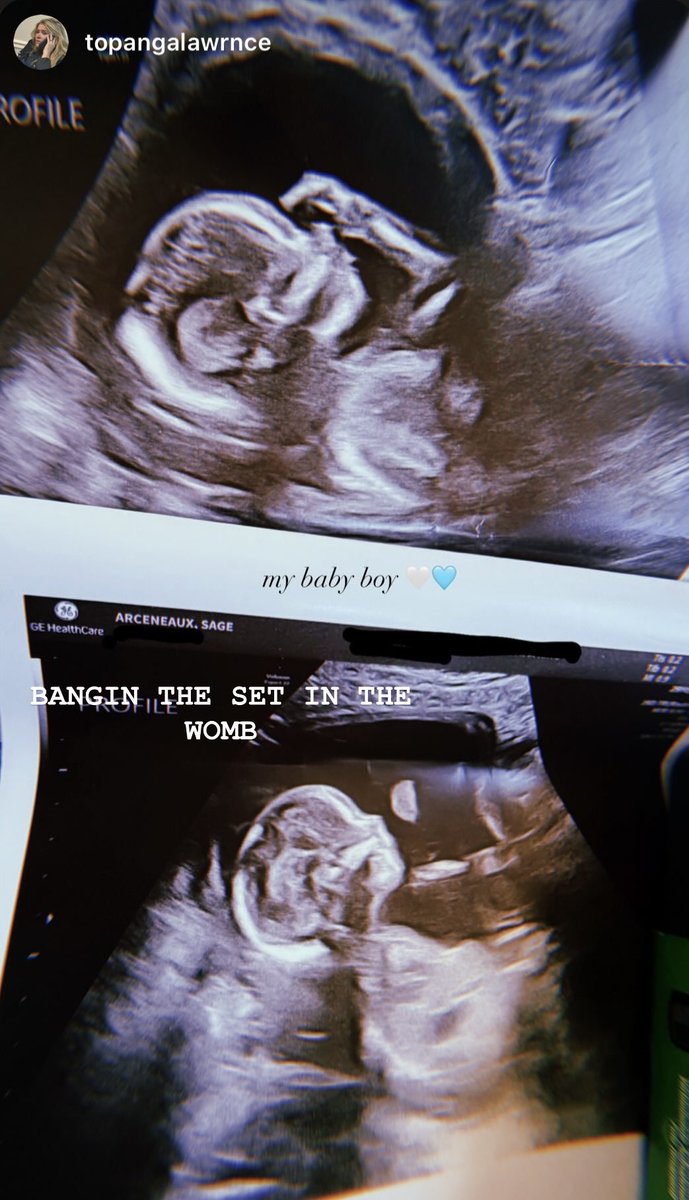 RubysNephew's tweet photo. SCRIM AND SAGE REVEAL THEY’RE HAVING A BABY BOY https://t.co/RJB4go8o5s