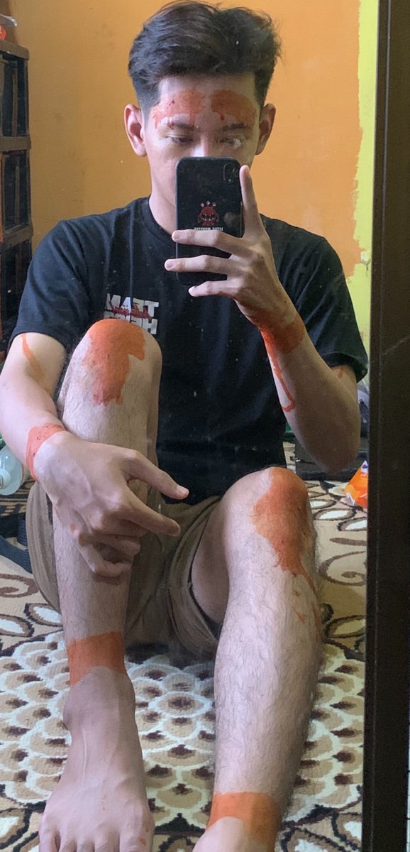 goodloovings's tweet photo. relate bgt sama cerita kamu kak

aku asli jawa, awal 2024 pindah rantau kerja ke kalimantan

hari pertama udah dapet "mimpi" dikalungin dayang2 di hutan sampe kos heboh karena muncul teori bakal dibawa ke saranjana🙂 (ini gweh mana jadi takut beneran woi)

belum genap seminggu tiba2 deman lama sampe akhirnya di bawa ke orang pinter dan diobatin pake bapidara ini😭 dibilang ada kaitan sama penunggu kos (ini ada critanya sendiri🤣) 

terus ga lama dr itu sempet ngalamin kclakaan sampe cuma bisa di kantor doang, pdhal gweh sales marketing yg tiap hari kudu keliling ke pergudangan🥲

sama beberapa kjadian2 yg gue gabisa cerita

endingnya bertahan 1,5 tahun aja dan pulang 😭