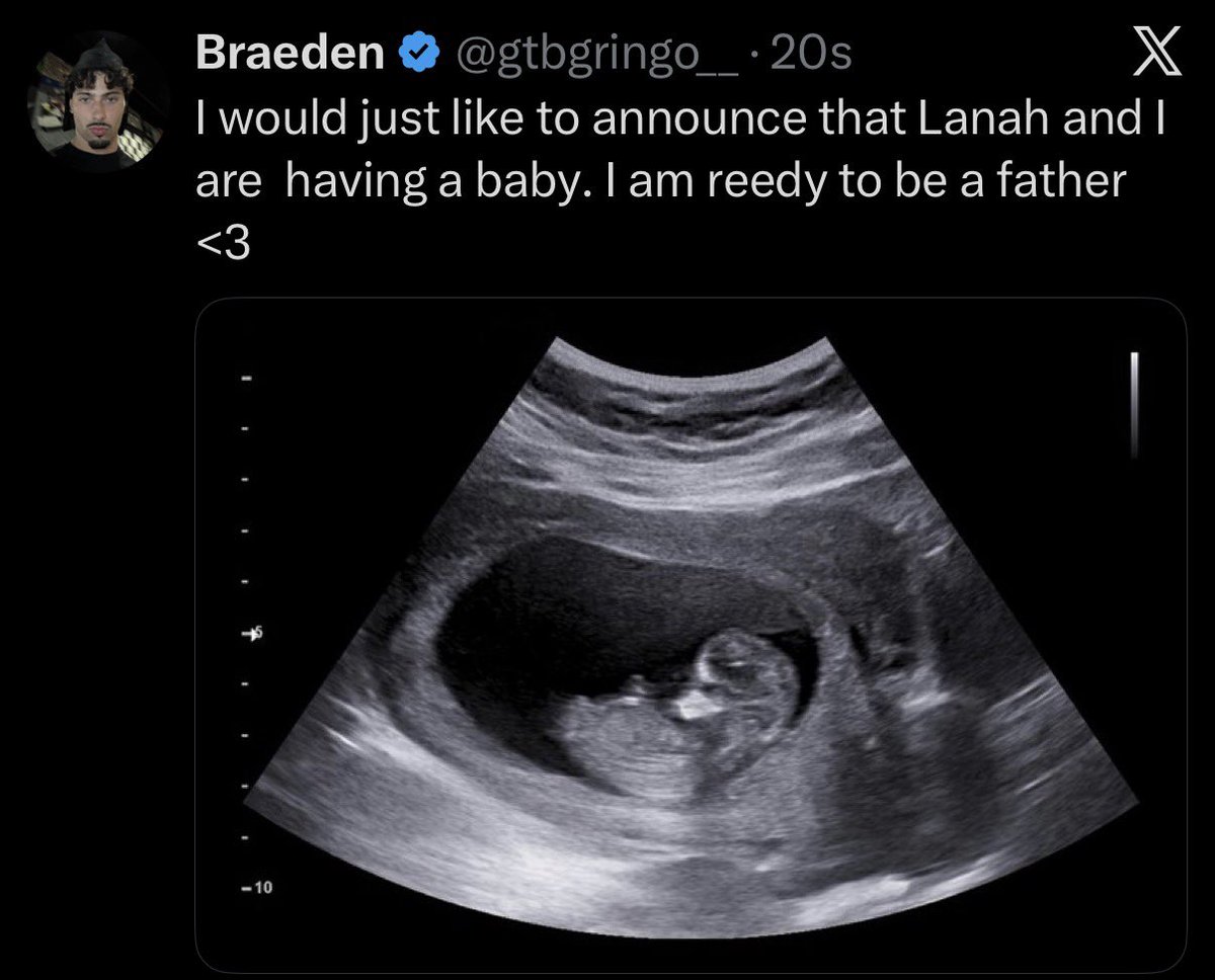 BraedenDaily's tweet photo. Braeden announced that him and Lanah Cherry are having a Baby….😳🚨‼️ https://t.co/PLZsq8CWv3