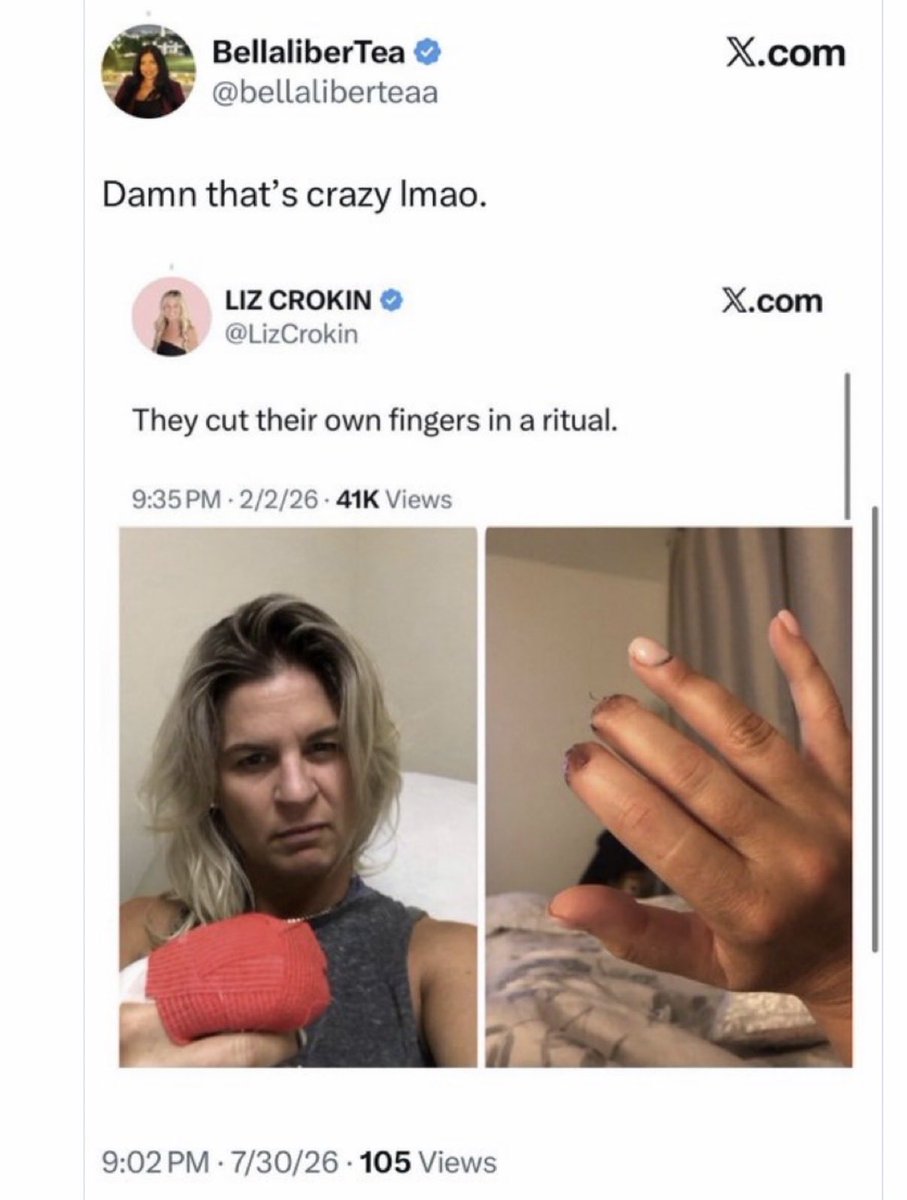 LizCrokin's tweet photo. Bella Rodriguez created a fake tweet using a real photo of my severed fingers from a traumatic surf accident, pushing the narrative that I chopped off my own fingers and “LMFAOing” about it. She has been engaged in a relentless, targeted smear campaign against me along with several others for months —malicious, coordinated, and clearly designed to destroy my mental health and push me toward self-harm.

Tonight she posted a tweet claiming to be horrified by the video of Perez Hilton self-harming, offered prayers, and called the situation “devastating.” The irony of her stating she’s horrified by Perez cutting himself when the other day she implied I chopped off my own fingers to defame and shame me, and laughed about it, should not be lost on anyone. Immediately after her post about Perez, she went straight back to posting another tweet attacking me.

There are many documented cases of people who have taken their own lives as a direct result of sustained online bullying and smear campaigns. David Wilcock was a victim of this kind of harassment and ended his life earlier this year. This is exactly why I am documenting every instance of this nonstop abuse from her and others, and why I am pursuing every available criminal and legal avenue.

Suicide, self-harm and mental health problems are often the result when monsters like Bella — who I am certain is paid to attack me — engage in relentless criminal cyber harassment and bullying campaigns against individuals.

I pray Perez is OK and gets the help he needs.