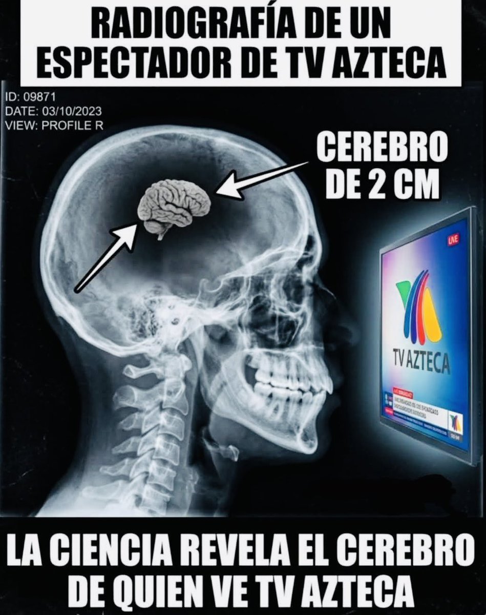 AlejandraToQuin's tweet photo. @jose_anbriz NO VEAN TV APESTA, SE TE ENCOJE EL CEREBRO! https://t.co/6h0nCLBOuA