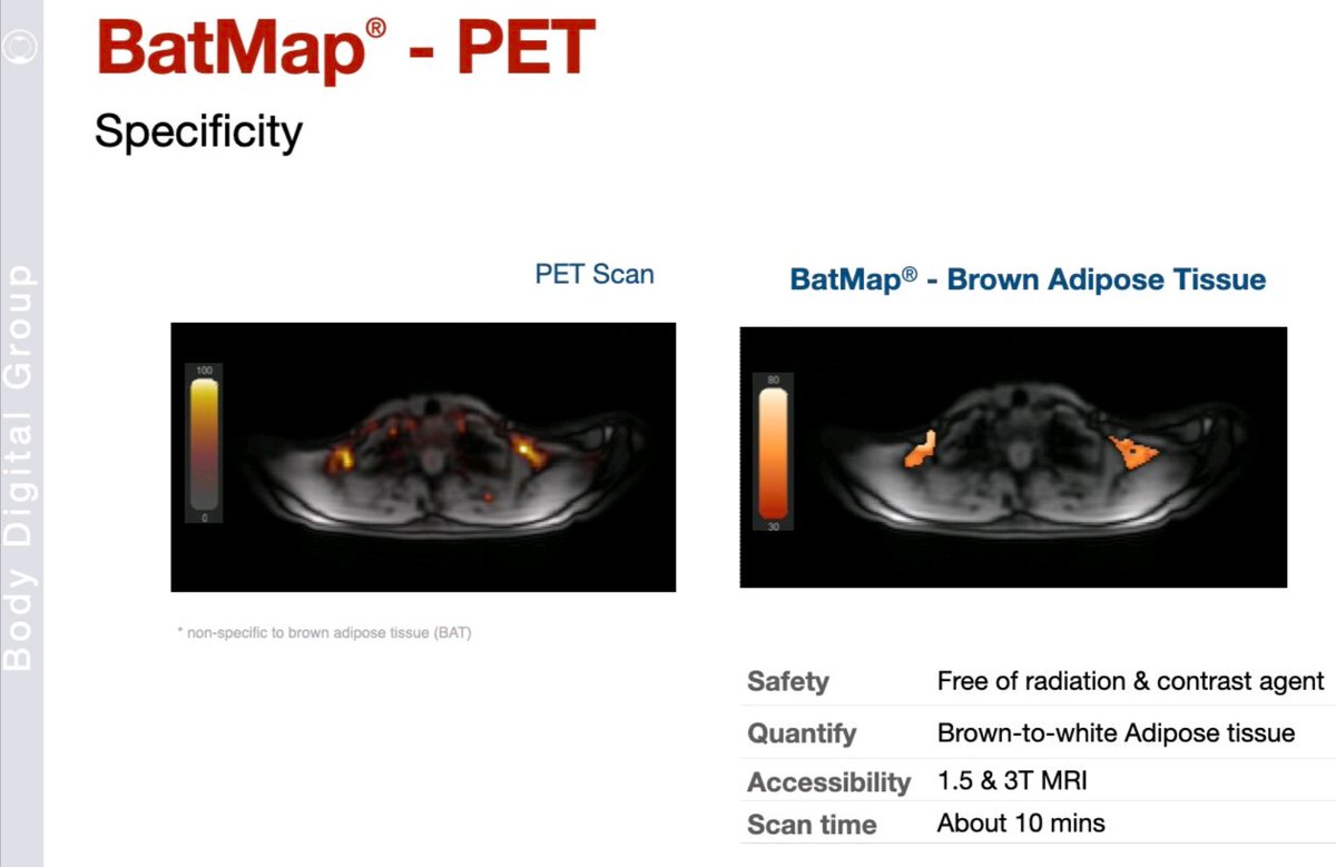 bodymapdigital's tweet photo. 🔥 What is brown adipose tissue (#BAT)? It's active, fat-burning tissue that drives energy expenditure, linked to #Metabolism & healthy #Ageing.
⭐ #BATMap by #BodyDigital makes this hidden biology measurable using #MRI— no ionising radiation, ~10 minutes to track #interventions. https://t.co/mS9CfEysZa