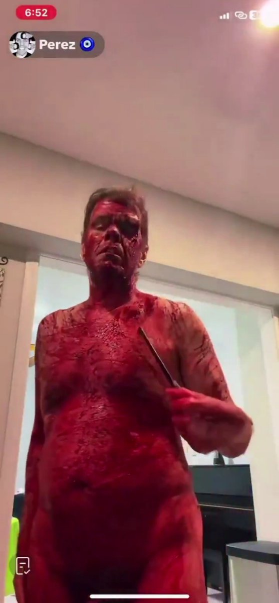 MikePilbean's tweet photo. Perez Hilton is an example of why we shouldn't normalize, coddle &amp; encourage mental illness.

Supporting people &amp; movements that are detrimental to the human condition doesn't prove that you have empathy.

It shows you don't know why powerful entities push society to accept it. https://t.co/7XTZ4Mq4dj