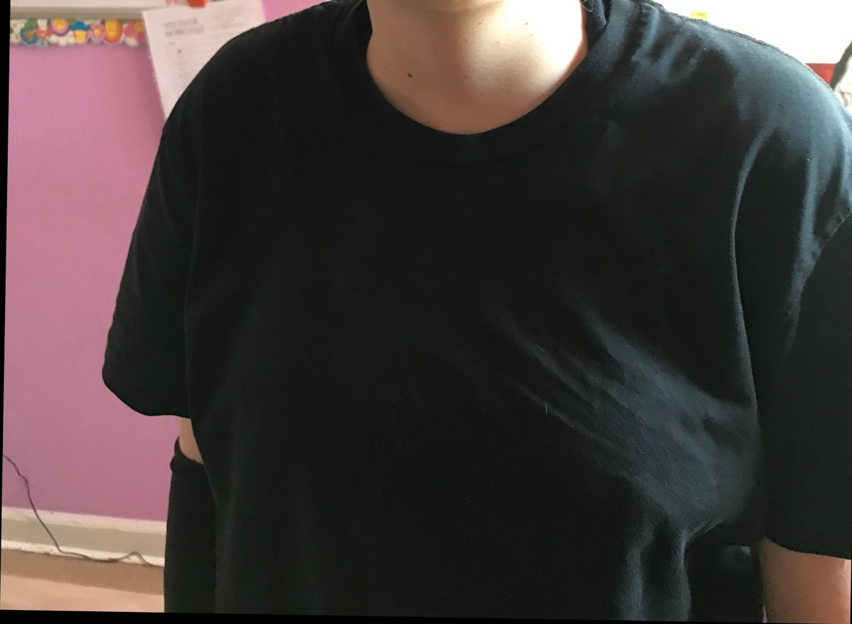 Crysta1ange1's tweet photo. I don't rlly like my doctor bc she said gaining weight wouldn't make my chest significantly bigger but she doesn't get how much a difference this is 4 me, 90lbs vs 120lbs erm I'd rather die https://t.co/b3tsrayA5t