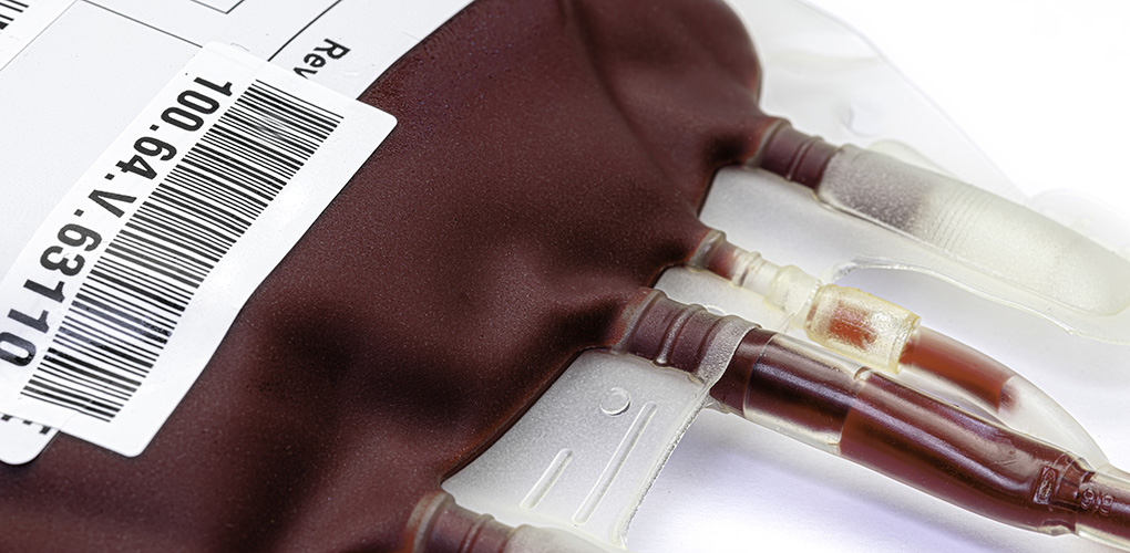 RCPath's tweet photo. Many patients, at all ages, receive blood transfusions. But are all these transfusions needed, and do we have sufficient understanding of the balance between benefits and risks? Learn how real patient data is improving transfusion services in the Bulletin: https://t.co/scGkhZJtQG https://t.co/A7jQlzIHo9