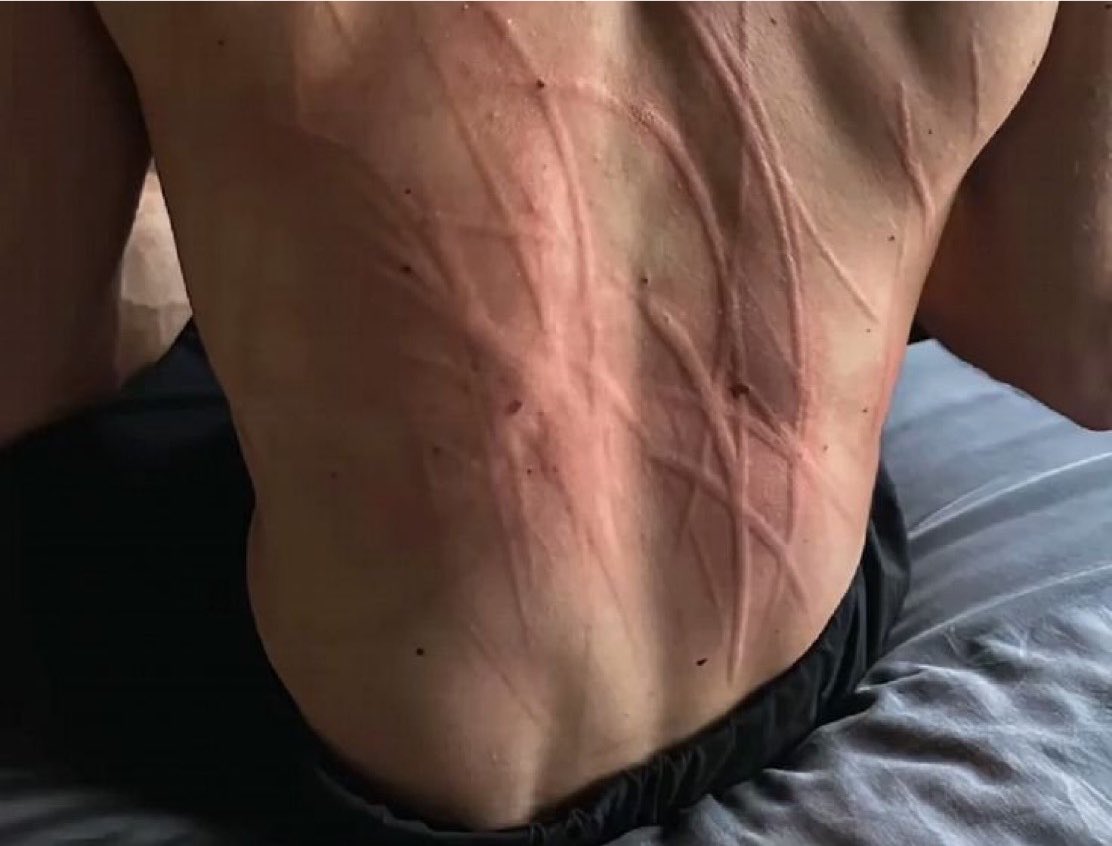 grmv363's tweet photo. max’s back vs george’s thighs iykyk
#russtappen https://t.co/uCFhc5W2NJ