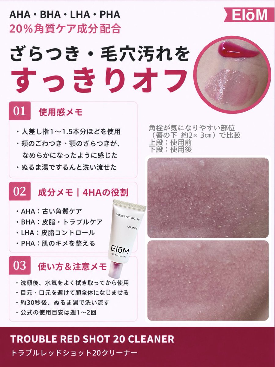 hiyori_skinlog's tweet photo. 🏷️PR | EiōM @eiom_jp
❤️トラブルレッドショット20クリーナー

洗顔後に塗って約30秒でできる角質ケア🫧
とろっとした真っ赤なジェルが目を引く商品👀✨

頬のごわつきと顎のざらつきも、前よりなめらかになったように感じた🥹
比較写真は角栓みっちり映ってるから閲覧注意😅（お恥ずかしい…）
⬇️続 https://t.co/qU66gFwMuV