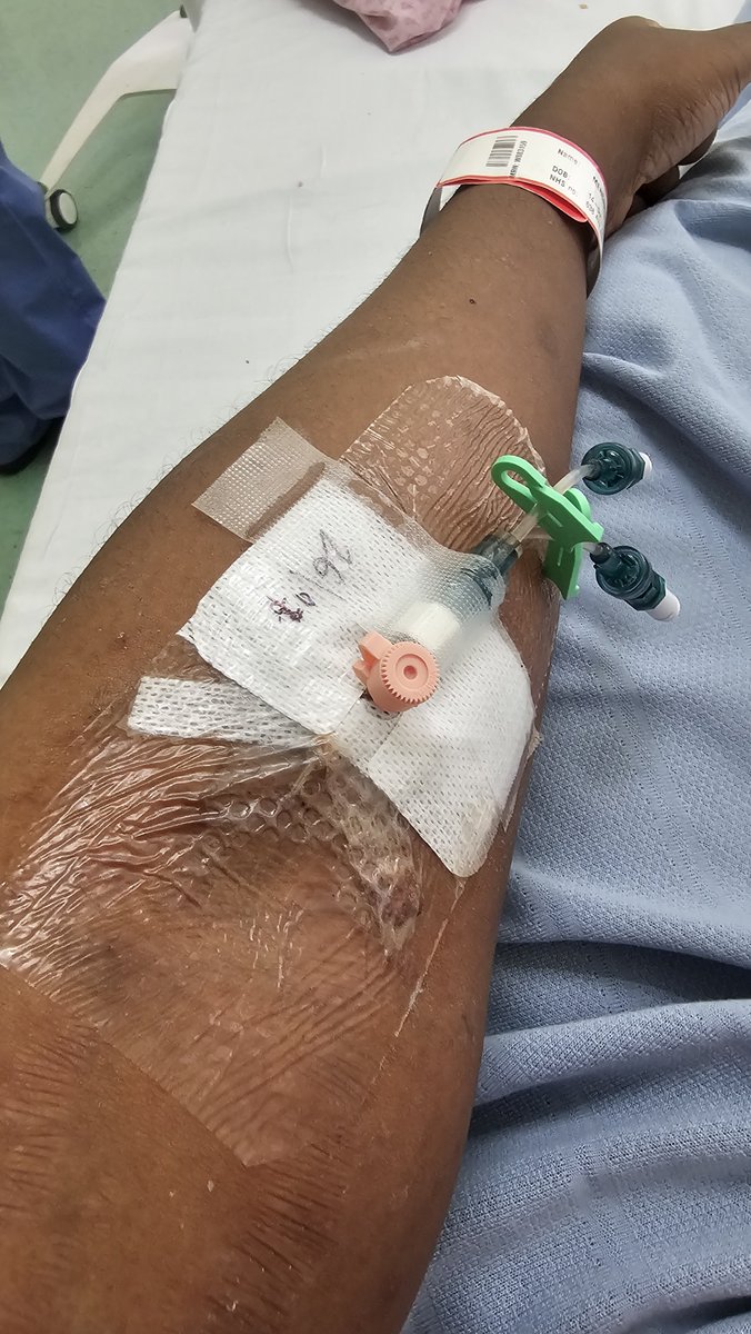 MissStarlet14's tweet photo. Bruh, I haven't bent my arm in TWO WEEKS because of this thing 😮‍💨 #sicklecell https://t.co/3dYyLZC4UR