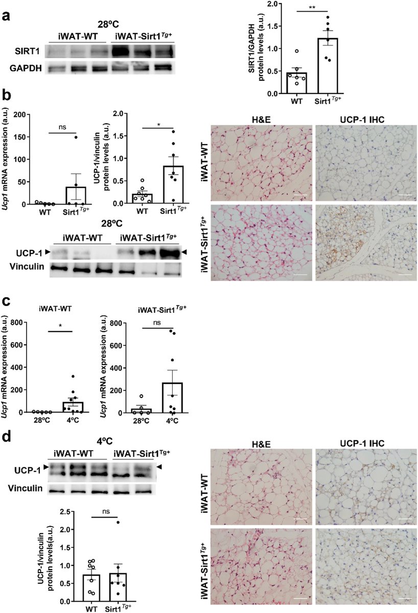 JPBY_official's tweet photo. Sirtuin 1 overexpression in mice preserves insulin and thermogenic responses in subcutaneous inguinal white adipose tissue under proinflammatory conditions https://t.co/tbcXvRz54N
@IIBmCSICUAM @CIBER_ISCIII @CIB_CSIC #iWAT #SIRT1 #Browning https://t.co/wGSEH52wbj