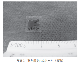 AoringoDr's tweet photo. 🚨たった1cmのシールが、全身麻酔での手術につながることがあります。
「シールくらい…」と思っていませんか？

【Injury Alert No. 55】0歳7か月の女の子が、1.0×1.0cmのプラスチック製のシールを誤飲した事例です。 
・咳と共に少量の血が出て受診したところ、シールが気道の入り口（声門の直上）に張り付いており、泣くたびに奥へ落ちそうな危険な状態でした。
・気管内に入ると窒息するリスクが高いため、最終的に「全身麻酔」での異物除去手術が行われました。

💡 なぜシールが怖いのか？ 
① 赤ちゃんの気道は激狭い！
・1歳児の気道の断面(声門部)は「約6mm × 2.5mm」しかありません。たった1cmのシールでも、容易に気道を塞いで窒息に繋がる危険性があります。

 ② レントゲンに写らない！ 
・プラスチック素材はX線に写らないため、診断が難航し発見が遅れることがあります。
・過去には喘息などと間違われて長期間発見されなかったケースも報告されています。 

③ 自力で出せない！ 
・赤ちゃんは咳をする力が弱く、気道に入った異物を自力で咳き出して除去することが十分にできません。

子どもが口に含んだら危険なものは、絶対に手の届かない場所へ。

お子さんを守るため、周囲のパパママにもぜひリポストで教えてあげてください🙇‍♂️