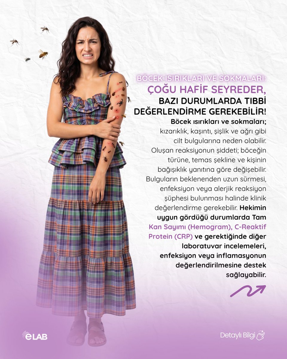 elab_bilgi's tweet photo. 🦟🩺 #BöcekIsırıkları ve Sokmaları: Çoğu Hafif Seyreder, Bazı Durumlarda Tıbbi Değerlendirme Gerekebilir! Sağlıkla ilgili kararlar yetkili sağlık uzmanlarına danışılarak alınmalıdır. Kaynak: https://t.co/0dMEPKAhPv https://t.co/ZoReSh7Nw1 https://t.co/IqWkMMI5bG